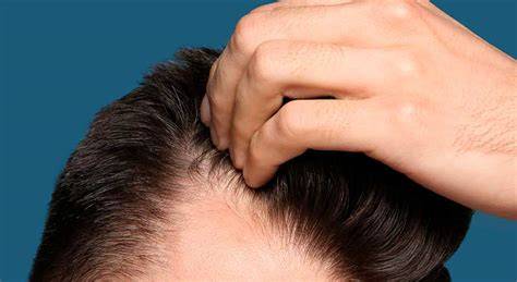 medición del crecimiento del cabello en el cuero cabelludo