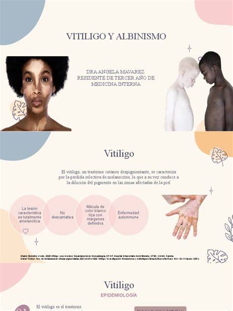 Comparación entre piel normal y vitíligo