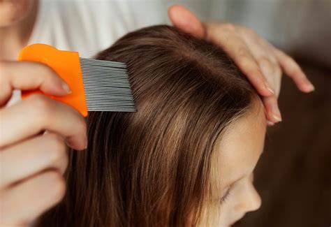 Diagnóstico de piojos con peine fino