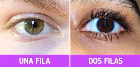 Distiquiasis con doble fila de pestañas