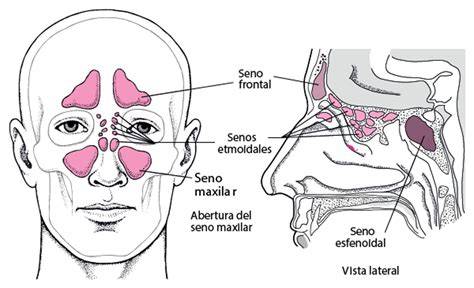 Senos paranasales y dolor sobre ceja