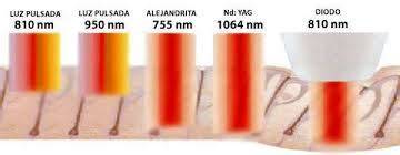 Comparación láser diodo Nd:YAG piel