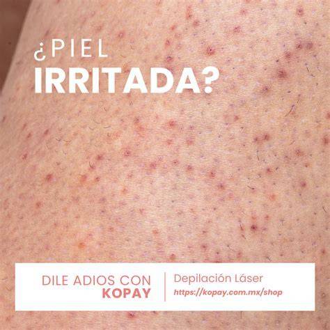 piel irritada después de depilación