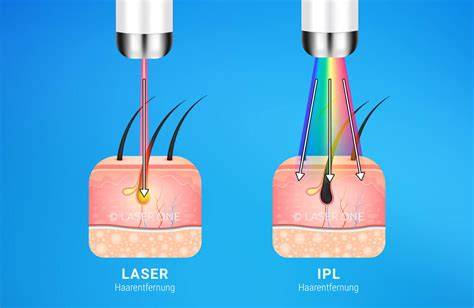 Comparación visual entre láser e IPL