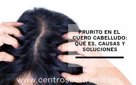 causas de irritación del cuero cabelludo