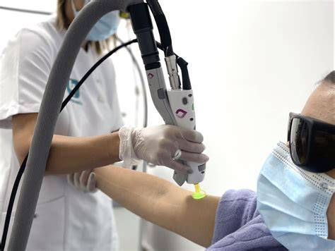Profesional sanitario aplicando láser de alejandrita