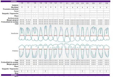 Periodontograma y medición de bolsas periodontales